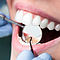 Přehled příspěvků zdravotních pojišťoven na dentální hygienu v roce 2022  - Využijte časově omezený příspěvek VZP