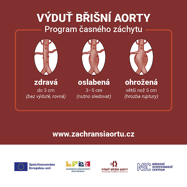 SCREENING ANEURYZMATU ABDOMINÁLNÍ AORTY